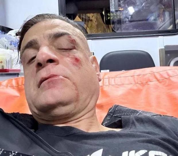 Cicalone, lo youtuber aggredito in metro a Roma